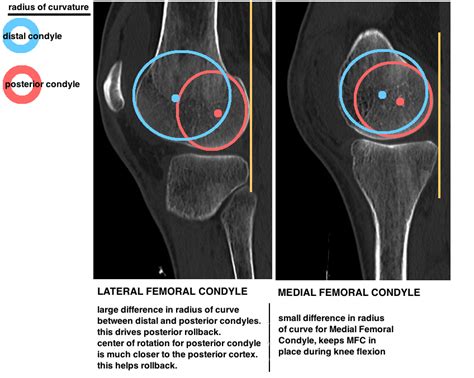 NATIVE KNEE KINEMATICS — Hip & Knee Book