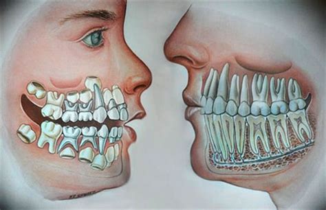 Dentaltown - Where The Dental Community Lives® | Dental, Dental art, Dental anatomy