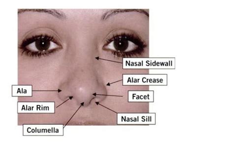 Nose Revision Surgery and Surgeons: Aesthetic nomenclature of the nose