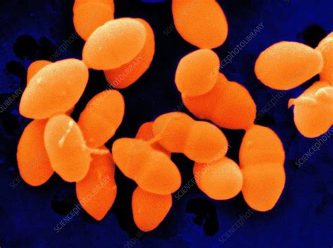 Streptococcus sanguis - Stock Image - B236/0167 - Science Photo Library