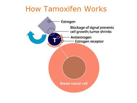 My Stage IV Cancer Experience: August 2015