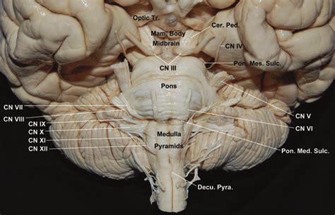 Brain Stem Anatomy Model