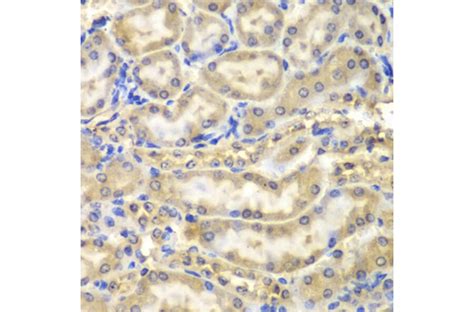 Anti-Myelin Basic Protein Antibody (A13581) | Antibodies.com