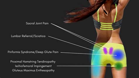 Posterior Hip Muscles