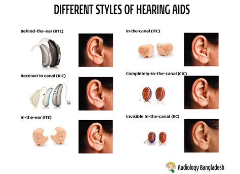 Pin on Audiology Bangladesh