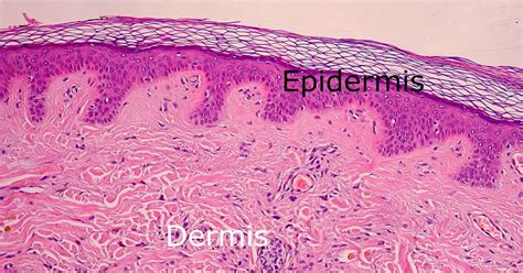 Dermis layers - Structure of dermis | the dynamic natural skin care