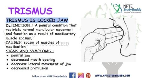 Pin on Musculoskeletal System-NPTESTUDYBUDDY