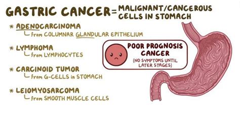 Gastric Cancer Symptoms