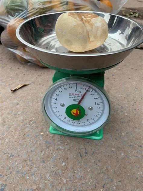 Batu Kandung Kemih Seberat 400 Gram Diangkat dari Kandung Kemih Seorang Wanita di Vietnam ...