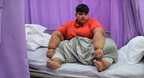 World's Heaviest Boy Weighs 196 Kg and Needs Life-Saving Operation