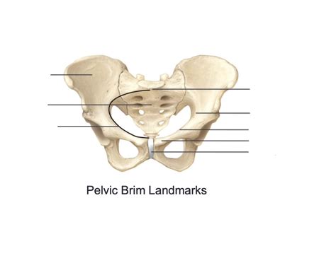 Pelvic Brim landmarks Quiz