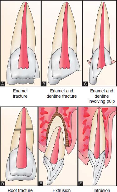 The Lifelong Benefits of Routine Dental Checks for Healthy Teeth | News | Dentagama