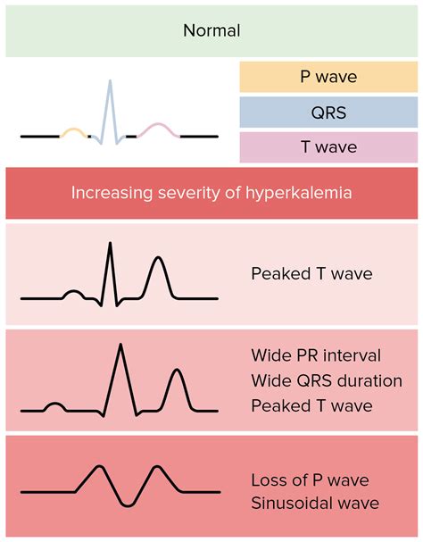 Hyperkalemia | Concise Medical Knowledge