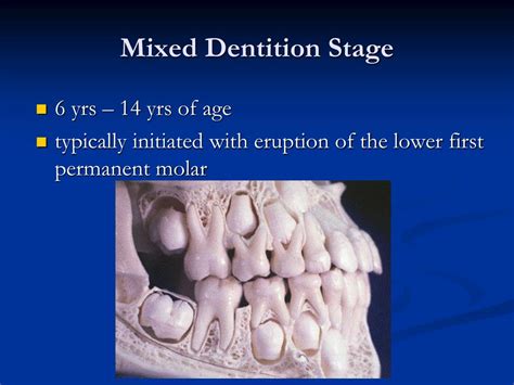 PPT - Pediatric Dentistry Seminar PowerPoint Presentation, free download - ID:4120622