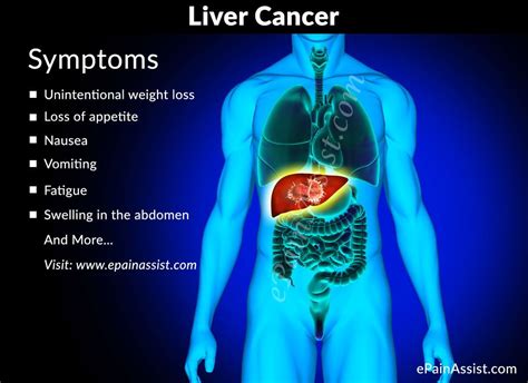 Pin on Abdominal Pain or Stomach Pain