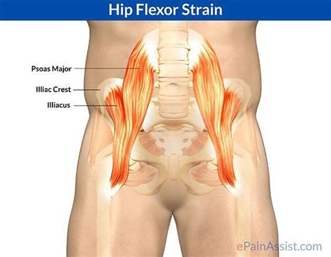 Hip Flexor Stretch: Hip flexor strain is also called as psoas strain ...