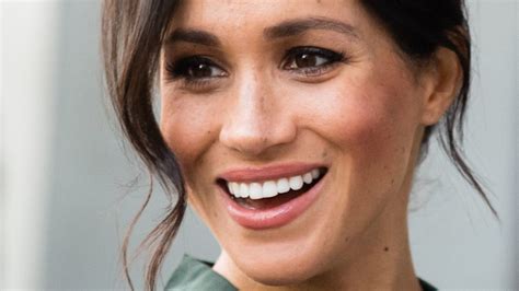 Meghan Markle's smile makeover: before and after photos | HELLO!