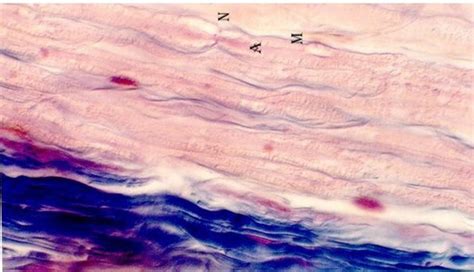 Peripheral Nerve Histology | Microanatomy Web Atlas | Gwen V. Childs, Ph.D.