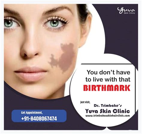 Get rid of your Birthmark at Trimbake's Yuva Skin Clinic at Dr. Trimbake Maternity Home and ...