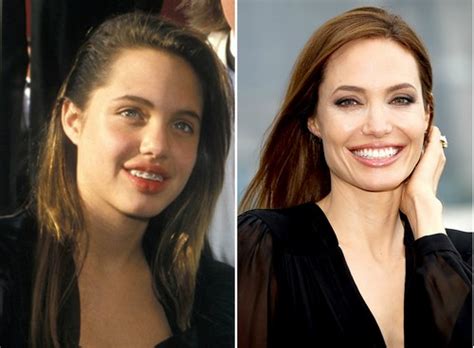 Top 10 Famous Actresses with Braces