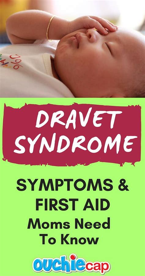 Dravet Syndrome Signs Symptoms & First Aid Moms Need To Know | Dravet syndrome, Syndrome ...