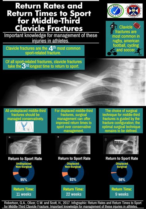 Broken Collarbone / Clavicle Fracture - Recovery Time & Tips