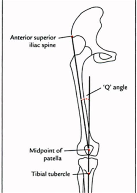 'Q' Angle - Physiopedia