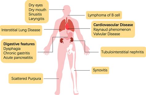 Sjogren Syndrome: Video, Anatomy, Definition Function, 48% OFF