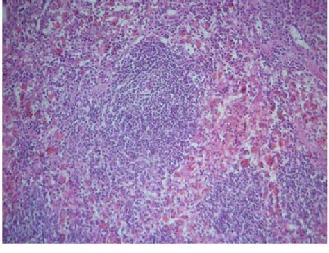 Microscopic morphology of a regenerated splenic autotransplant showing... | Download Scientific ...