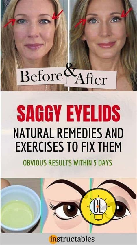 Hooded Eye Makeup Droopy Eyelids | Natural remedies, Eye exercises ...