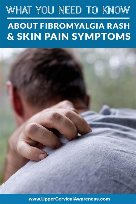 What You Need to Know About Fibromyalgia Rash & Skin Pain Symptoms