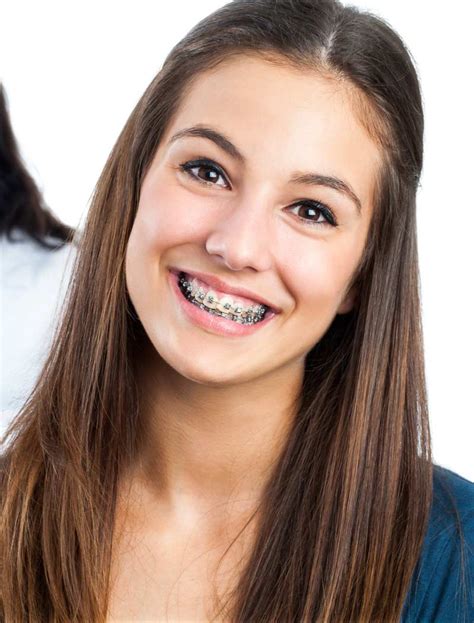 Braces for Adults | Orthodontist Ottawa ON | Centrepointe Orthodontics