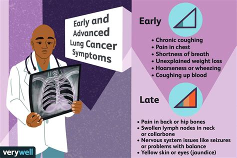 10 Facts about Lung Cancer All Singaporeans Should Know