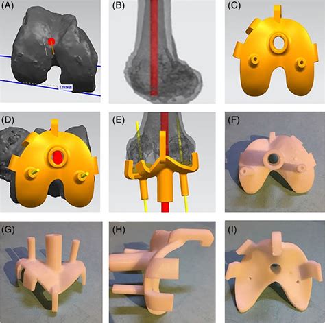 The process of designing PSI and the morphology of the PSI:(A, B)... | Download Scientific Diagram