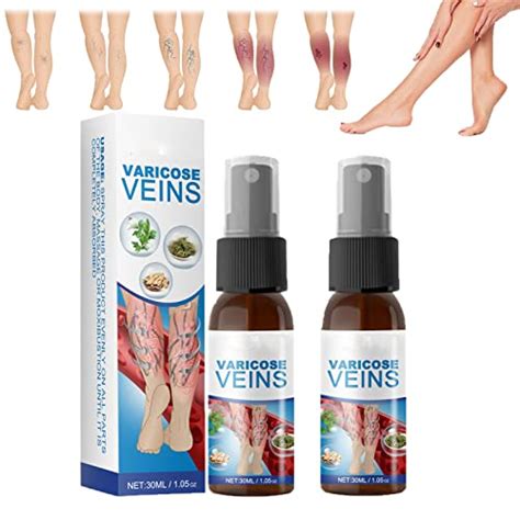 Best Leg Makeup For Varicose Veins, According To Dermatologists