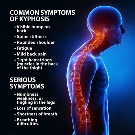 Kyphosis Symptoms, Treatment | Florida Orthopaedic Institute