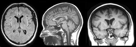 MRI Basics