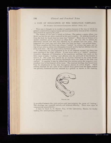 A case of dislocation of the semilunar cartilage | Journal of The Royal Naval Medical Service