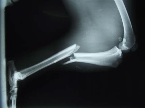 Casos clínicos de veterinaria en pequeños animales: FRACTURA DIAFISARIA CERRADA DE TIBIA Y PERONE