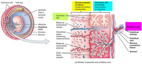 Placenta Accreta - Causes, Symptoms, Diagnosis, Risk Factors, Treatment