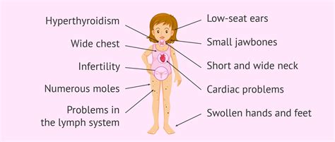 Xo Chromosome Abnormality