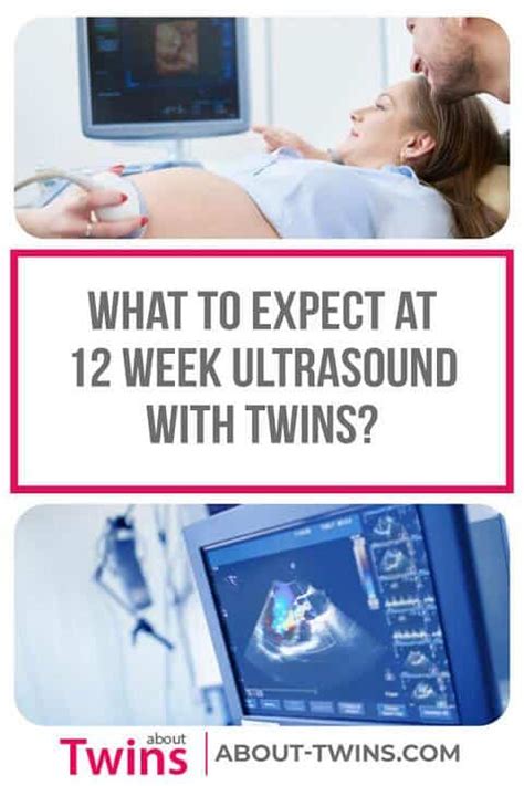 Twin Ultrasound 12 Weeks: Dating & Chorionicity Scan – About Twins