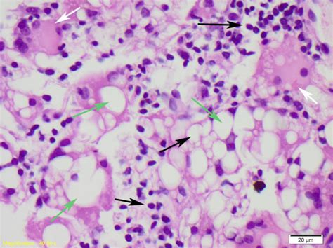 Macrophage Cell Histology