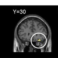 The right anterior insula (aINS) was used as the seed region for the ...