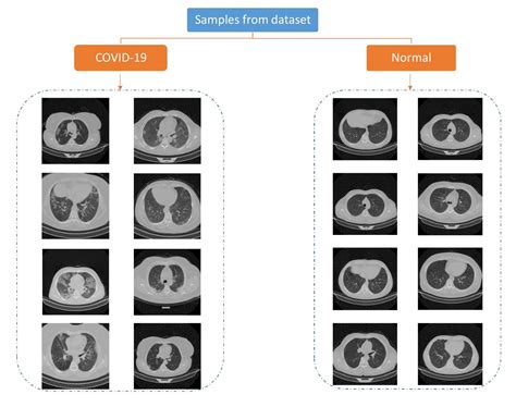 A Large Covid-19 CT Scans Dataset – FaraAI