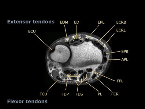 Wrist Tendon Anatomy