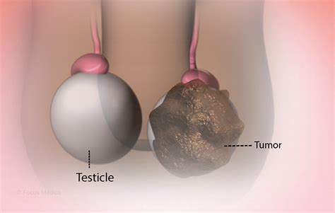 Health Condition : Symptoms, Causes, Treatment and More