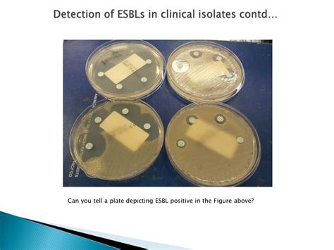 PPT - Extended-spectrum β -lactamase (ESBL) Production in ...