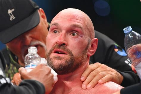 Tyson Fury ‘devastated’ as injury derails Oleksandr Usyk fight on two ...