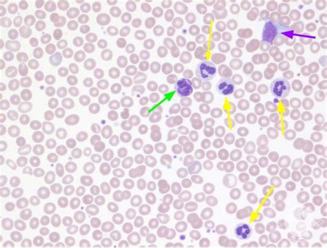 Normal Blood Smear